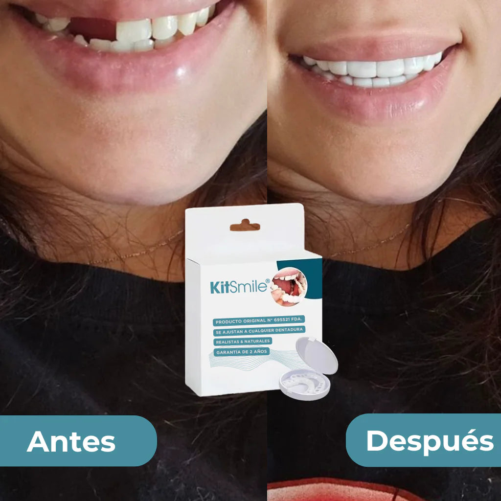 PROMOCION COMPRA 1 Y LLEVE 2 - KITSIMILE - CARILLAS DENTALES (KIT COMPLETO)