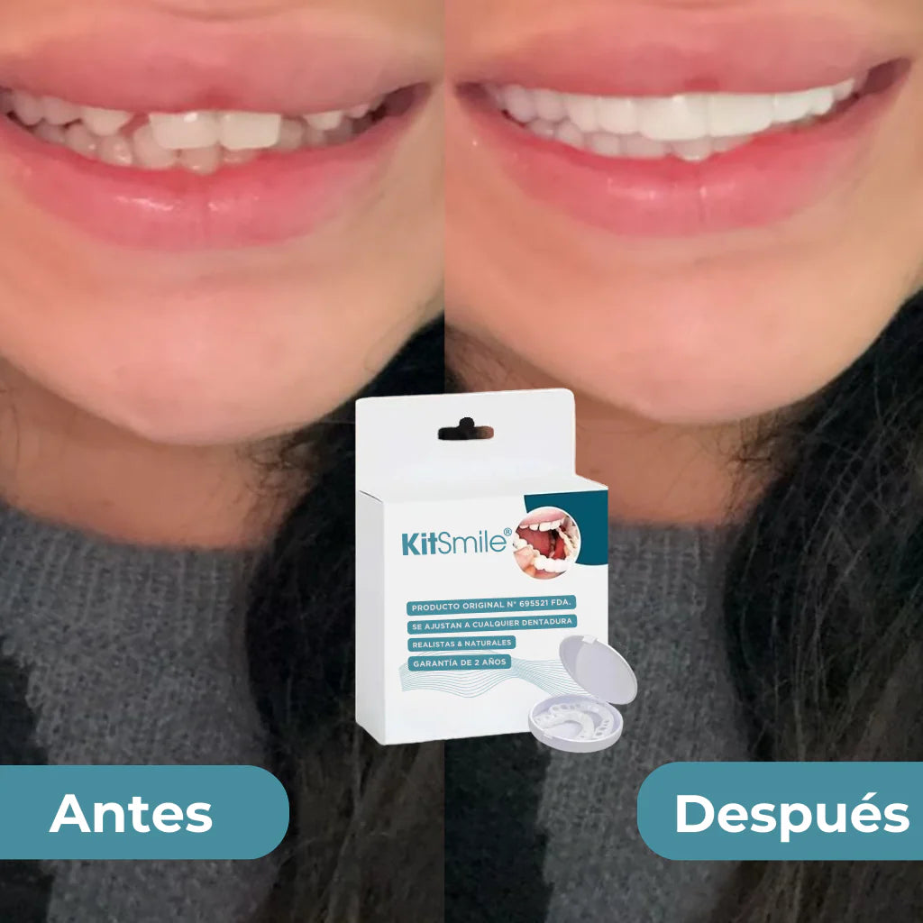 PROMOCION COMPRA 1 Y LLEVE 2 - KITSIMILE - CARILLAS DENTALES (KIT COMPLETO)