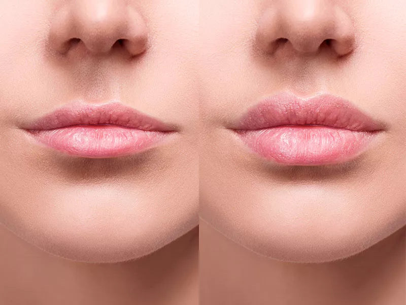 Colágeno Para Labios Hidratante