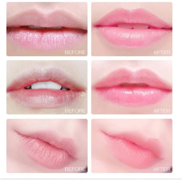 Colágeno Para Labios Hidratante